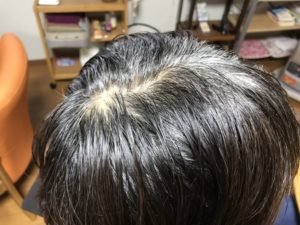 石臼挽きヘナW染め ビフォー 白髪